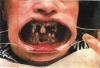 Photos dlires : Mauvaise dentition - 78757 hits