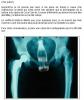 Humour noir : Excuse pour cong maladie - 21269 hits